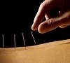 Акупунктура (рефлексотерапия, иглоукалывание), отдых все включено №11