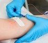 ВЛОК (внутривенное лазерное облучение крови), отдых все включено №2