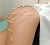 Озонотерапия, отдых все включено №9